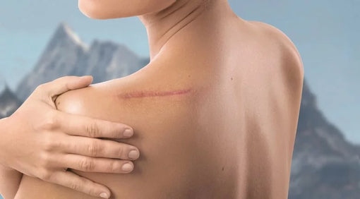 Cicatrici ed Osteopatia