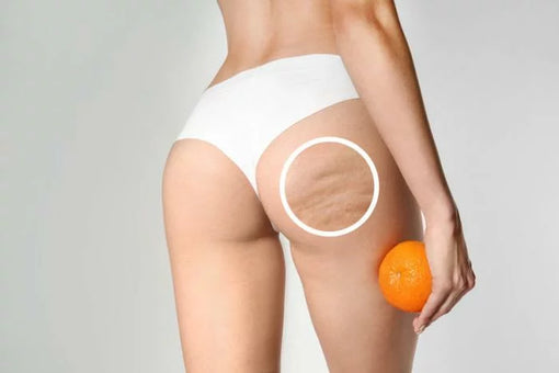 Addio CELLULITE